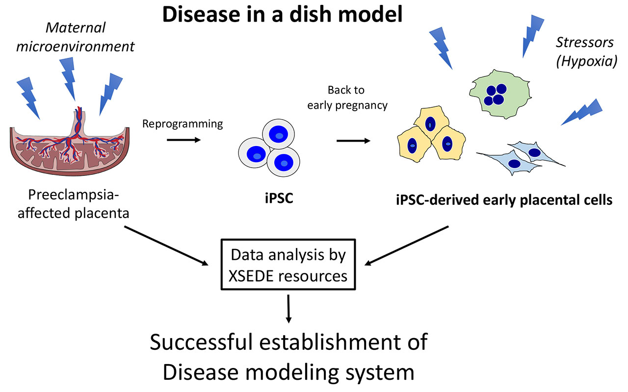 PR20210712_preeclampsia_fig.jpg