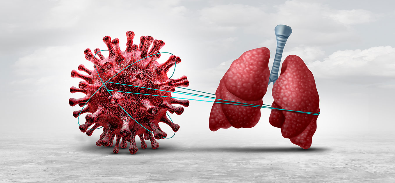 Illustration of covid virus tied to a pair of lungs