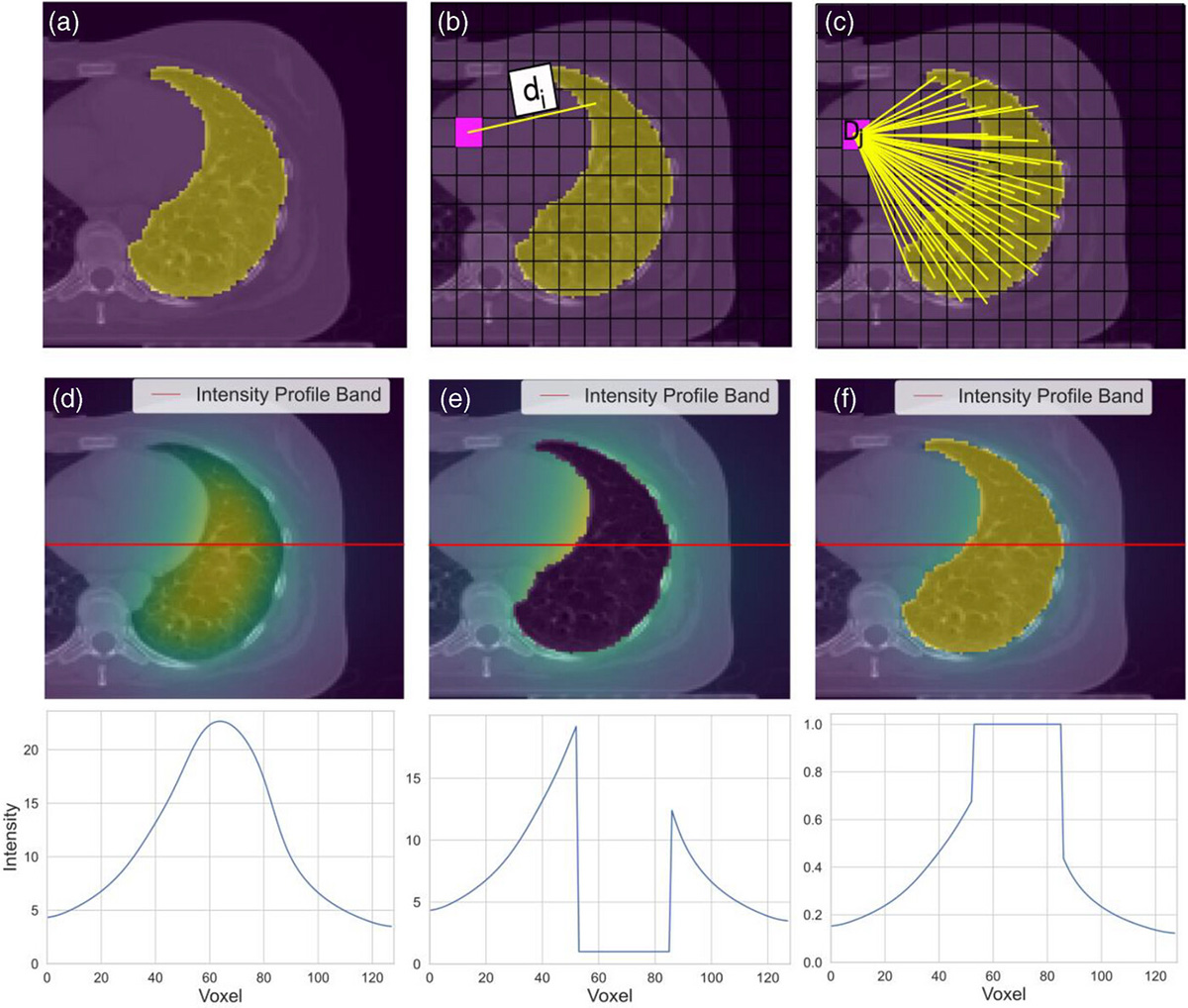 An illustration of the stages of the glowing mask algorithm, where distance from the organ is encoded into every pixel of the image