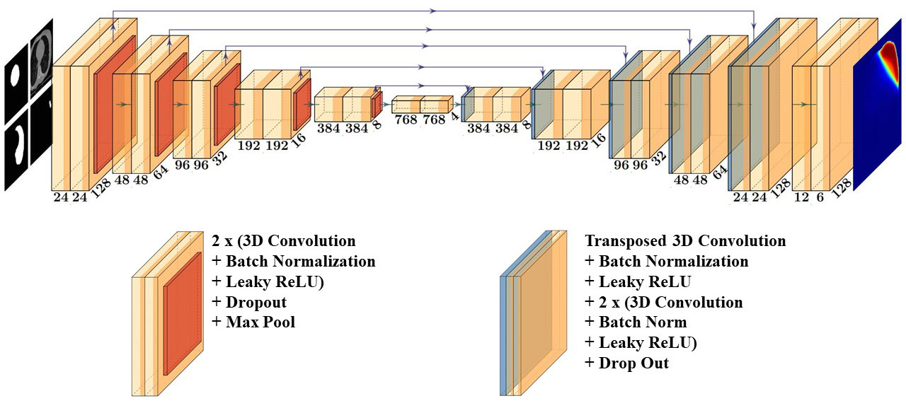 A depiction of the model, called a 3D U-Net, used for this project. The model uses the images of the patient from the treatment plan to predict what dose should be delivered.