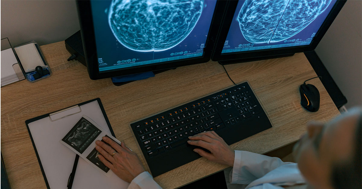 Top view of doctor analyzing breast scans.